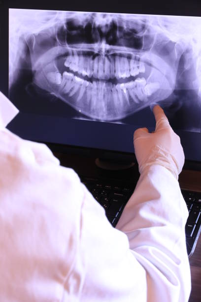 Best Emergency Root Canal Treatment in Bonnie Brae, IL