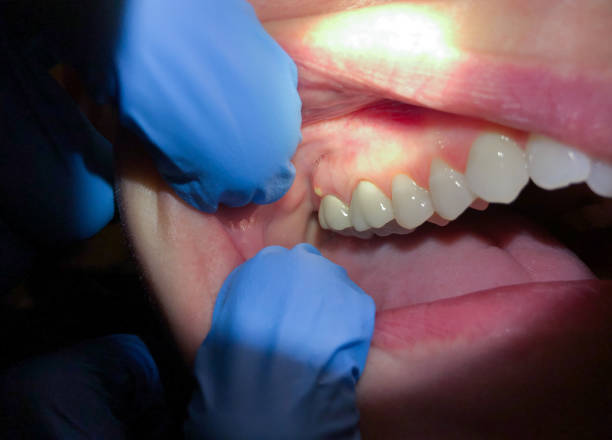 Best Orthodontic Emergency Dentist in Bonnie Brae, IL