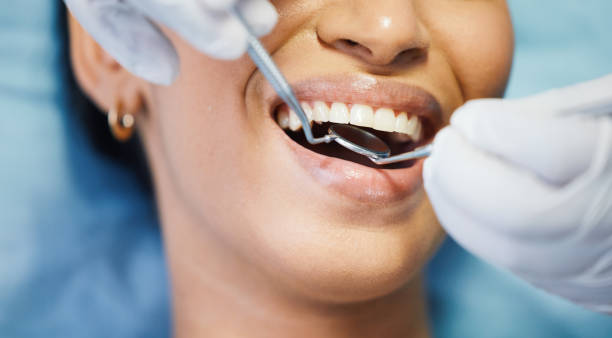 Best Emergency Dentist for Knocked-Out Tooth in Bonnie Brae, IL