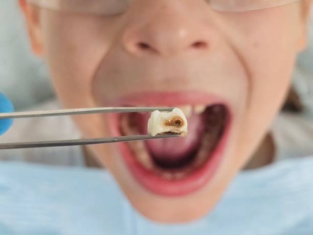 Best Emergency Dental Services for Seniors in Bonnie Brae, IL