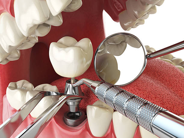 Best Weekend Emergency Dentist in Bonnie Brae, IL